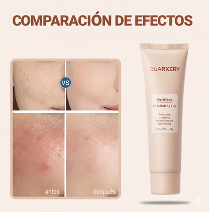 QUARXERY | Gel Exfoliante Facial Hidratante con Nicotinamida