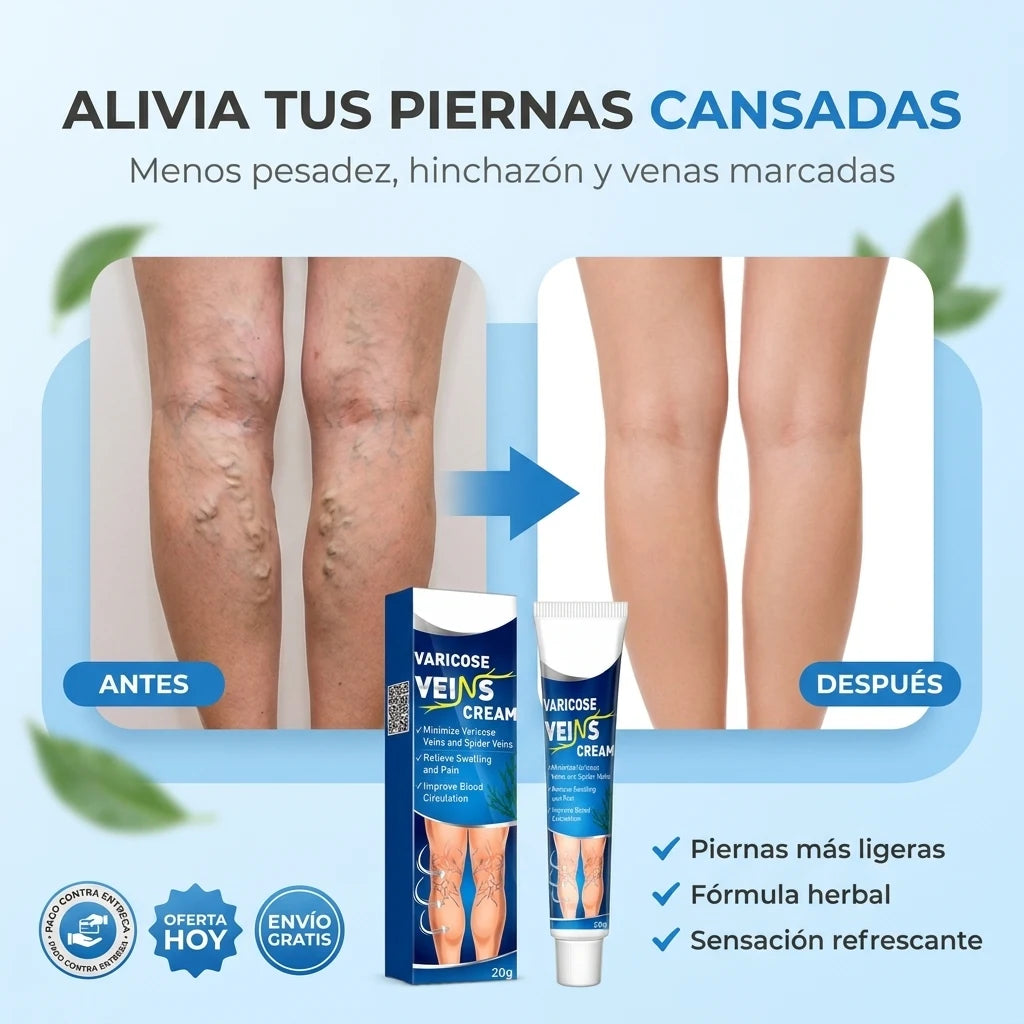 Crema para Várices VeinCare® | Alivia Pesadez y Mejora tus Piernas Cansadas