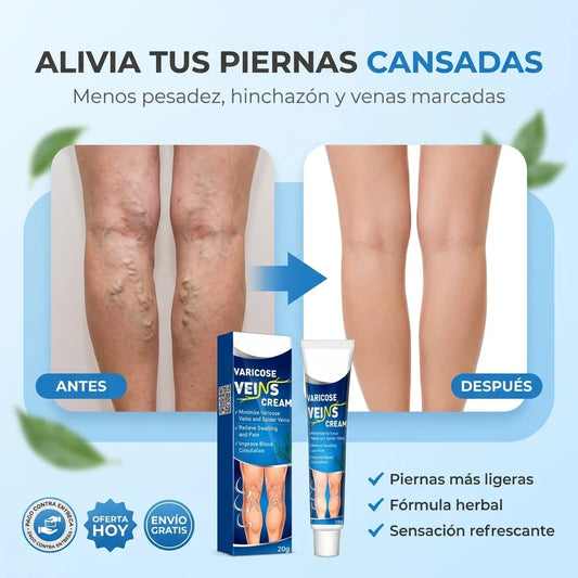 Crema para Várices VeinCare® | Alivia Pesadez y Mejora tus Piernas Cansadas