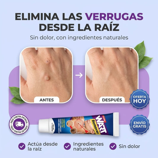 Crema Quita Verrugas SkinPure® | Elimina Verrugas Desde la Raíz, Sin Dolor