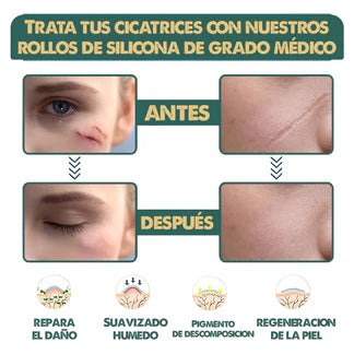 Cinta Médica Maguey V®: Borra tus Cicatrices y Recupera tu Confianza